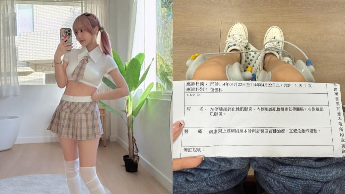 復健也沒用!啦啦隊女神「膝蓋鈣化」恐開刀 醫曝3族群風險高
