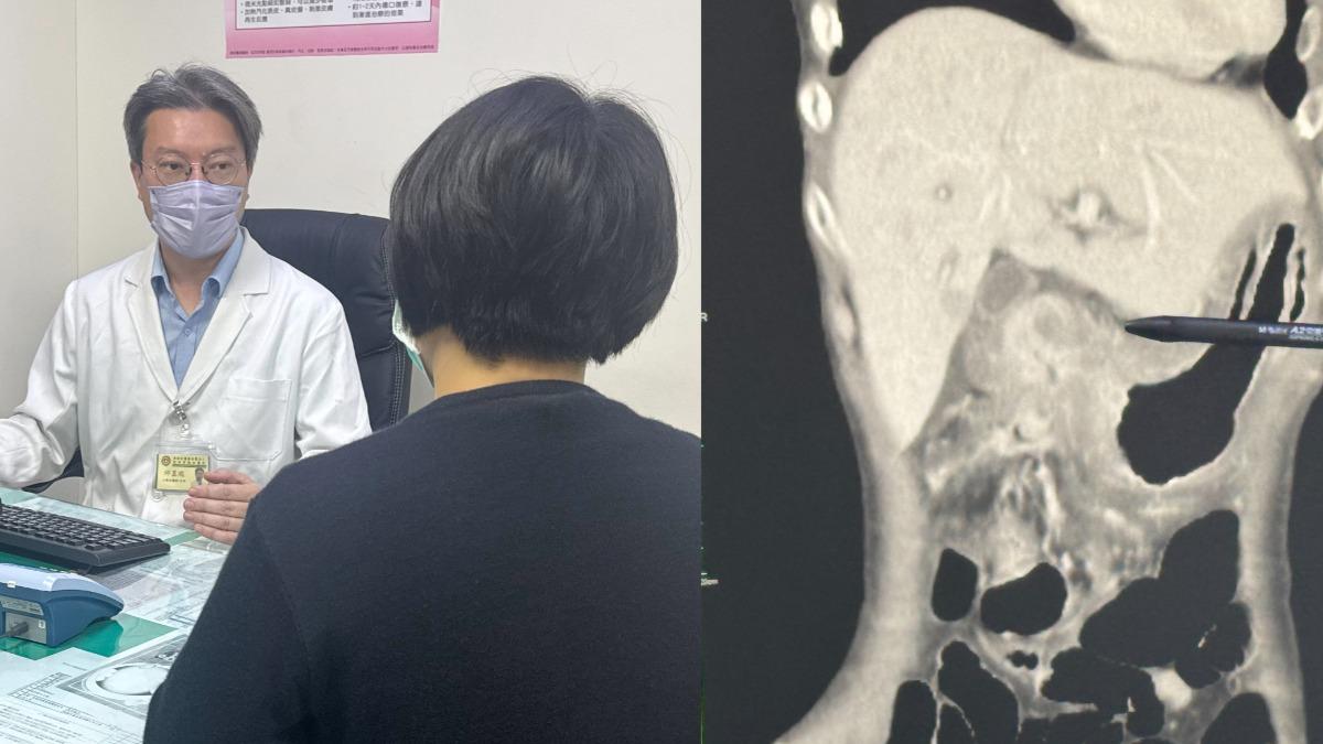 社畜小心!OL壓力大吃飯就吐爆瘦 輕忽胃痛「腸全塞住」
