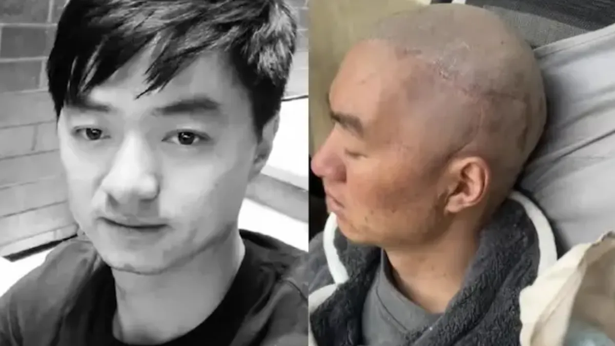 小楊哥「最惡腦腫瘤」癌逝！醫籲4族群要注意　奪命最快數月