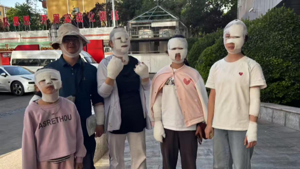 北京2家庭燒烤到一半「卡式爐爆炸」 7人受傷包成木乃伊
