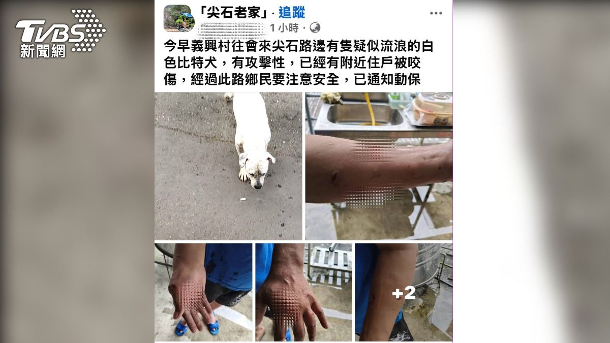 新竹縣2天連爆比特犬攻擊!民眾手臂被咬 流浪狗遭咬傷