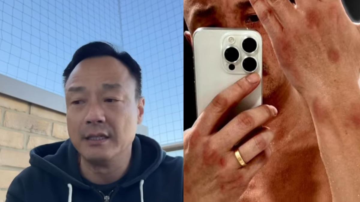男星自爆遭友人迷姦!喝紅豆湯後斷片 公開傷勢「醒來躺在糞便裡」