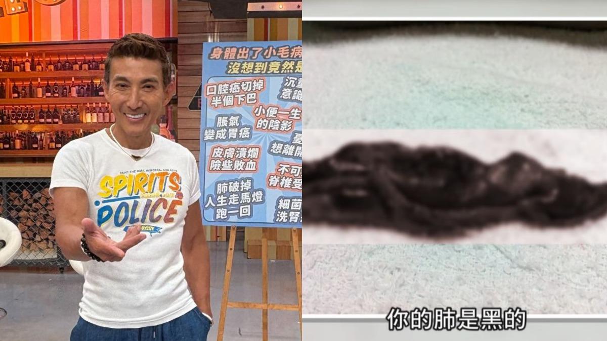 潘若迪昔「肺部黑一片」!命危送醫動刀 老婆忍痛簽放棄急救