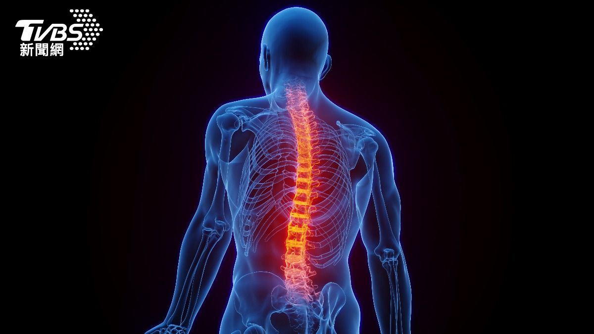 搬重物才椎間盤突出?研究揭6成病患「沒做什麼」 醫曝真正原因