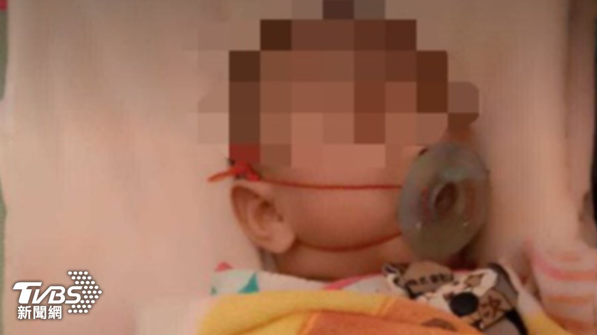 獨/幼嬰奶嘴綁線固定口可行?醫示警:繩勒到脖、耳恐潰瘍
