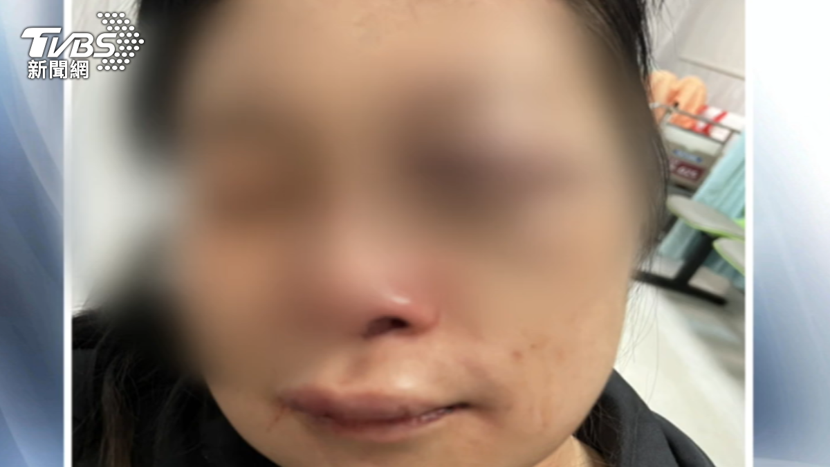 女牙醫被打傷。(圖/TVBS資料畫面)