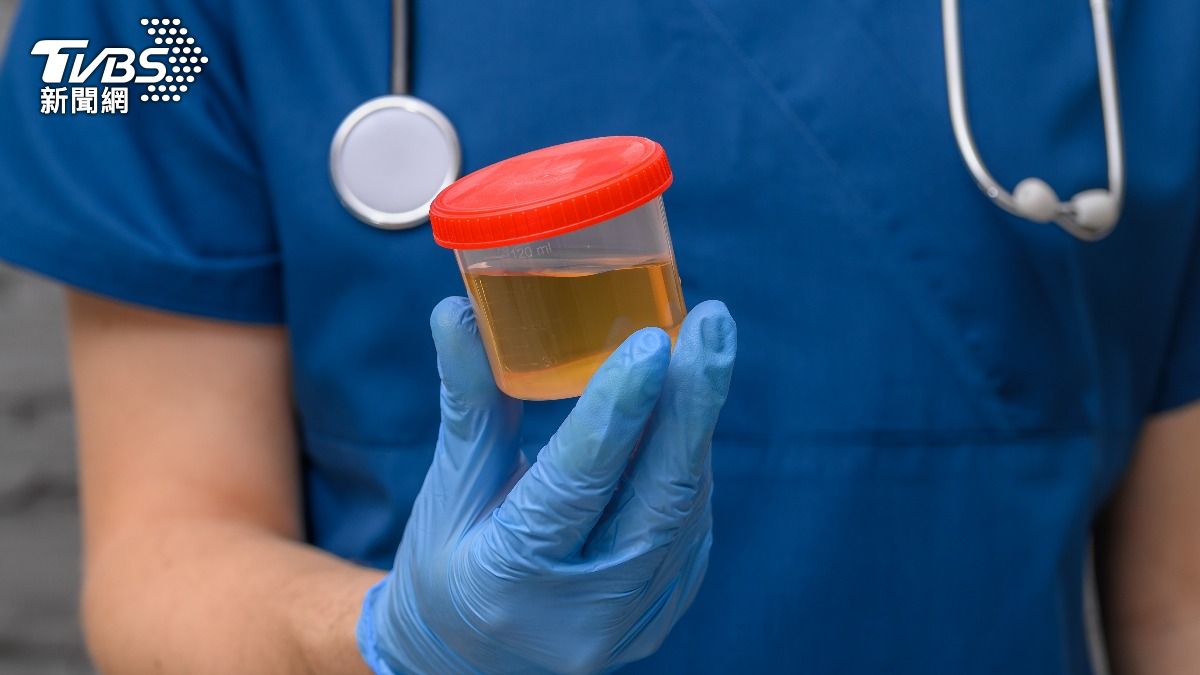 每日爆汗竟差點洗腎！中醫介入1個月見效　奇蹟逆轉腎病3b期