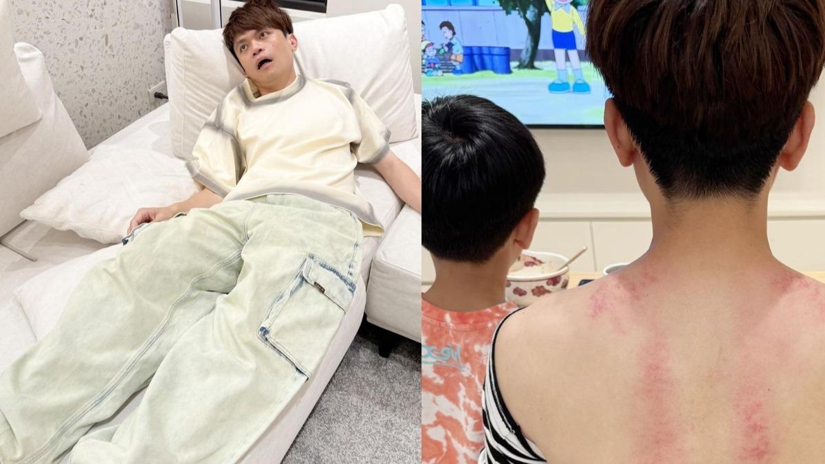 蔡阿嘎疑「耳石脫落」頭暈目眩　自曝暈了一整天都沒好