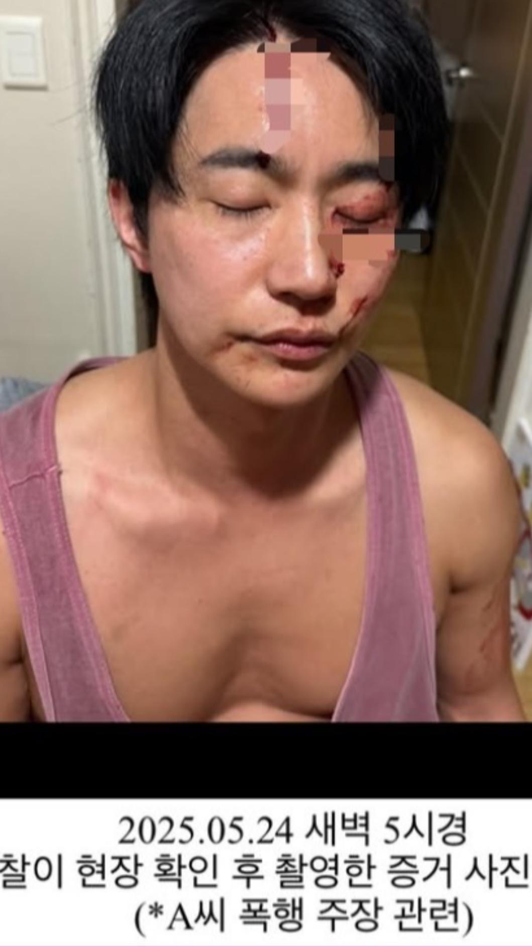 全浩俊曬出鼻青臉腫流血照,表示自己是正當防衛。(圖/翻攝自全浩俊IG)