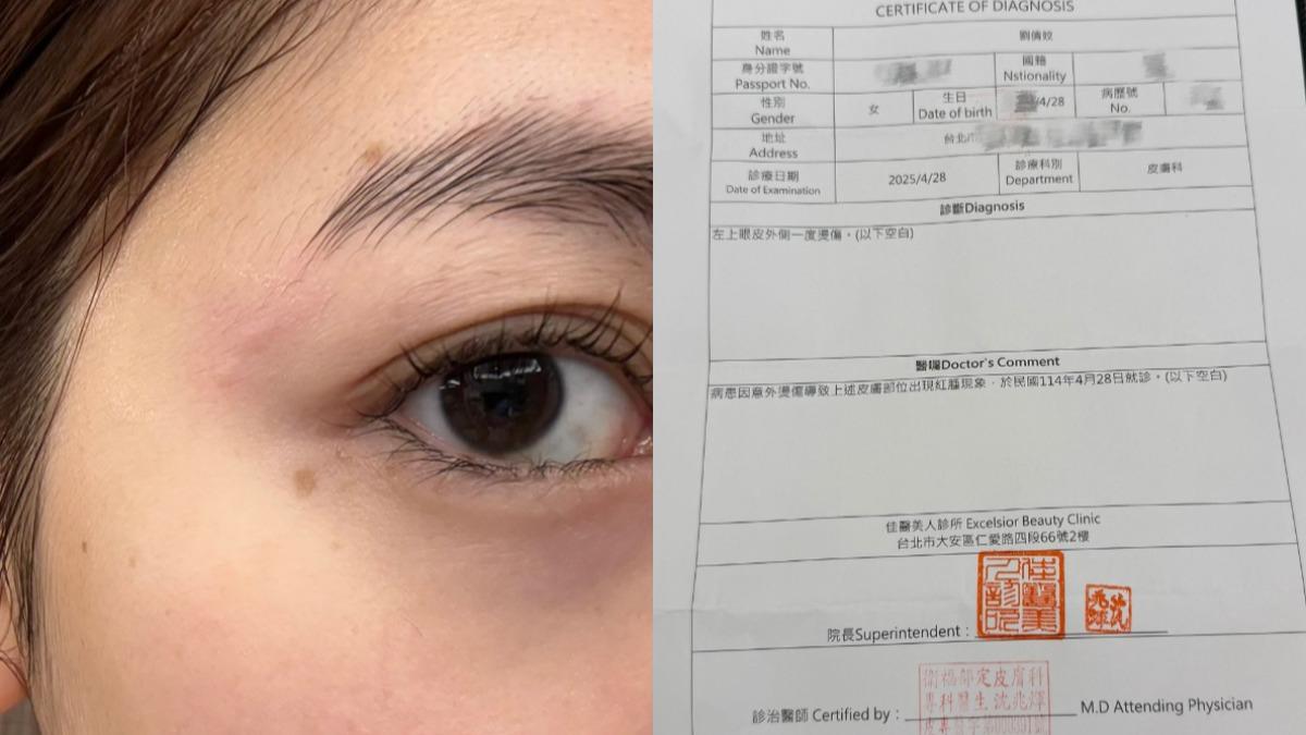 劉倩妏-劉倩妏燙傷-劉倩妏髮廊-劉倩妏演員-捲髮棒燙傷