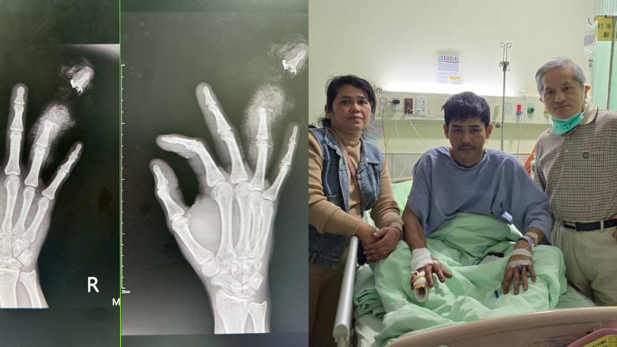9年沒見靠視訊！23歲男捲機台噴血斷指　媽宜蘭奔台中尋兒