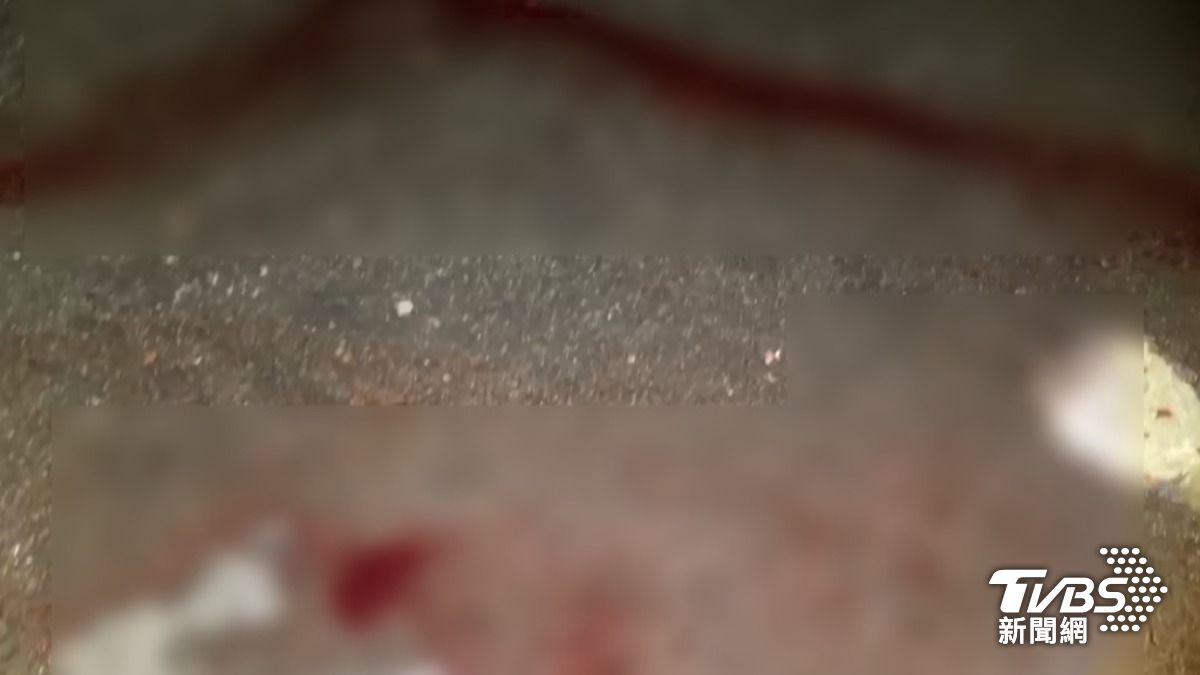 台中五權夜市1男遭斧頭猛砍!動手竟是哥哥 身上還搜出長刀