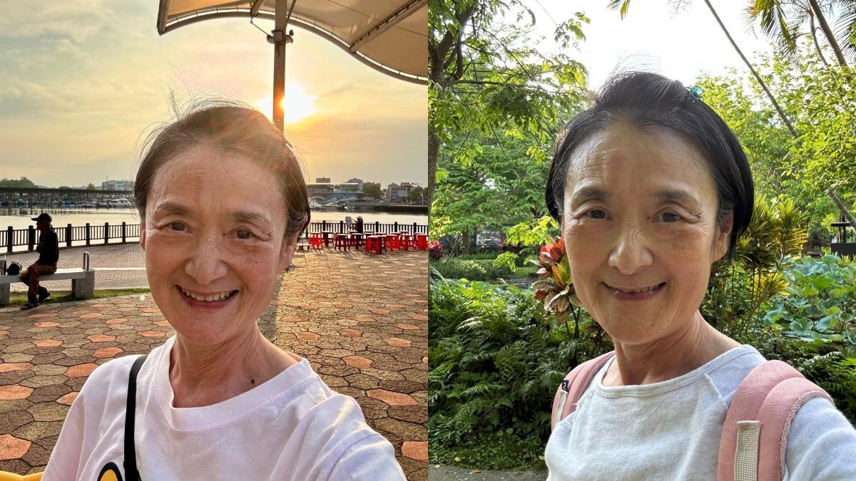 還以為被蟲咬!譚艾珍自爆得帶狀皰疹 醫:1部位恐傷視神經