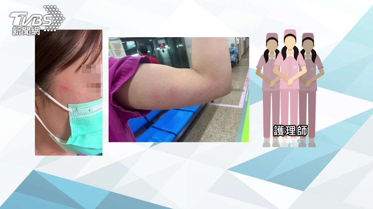 護理師遭翁毆「臉腫、手臂瘀青」已提告（圖／TVBS）