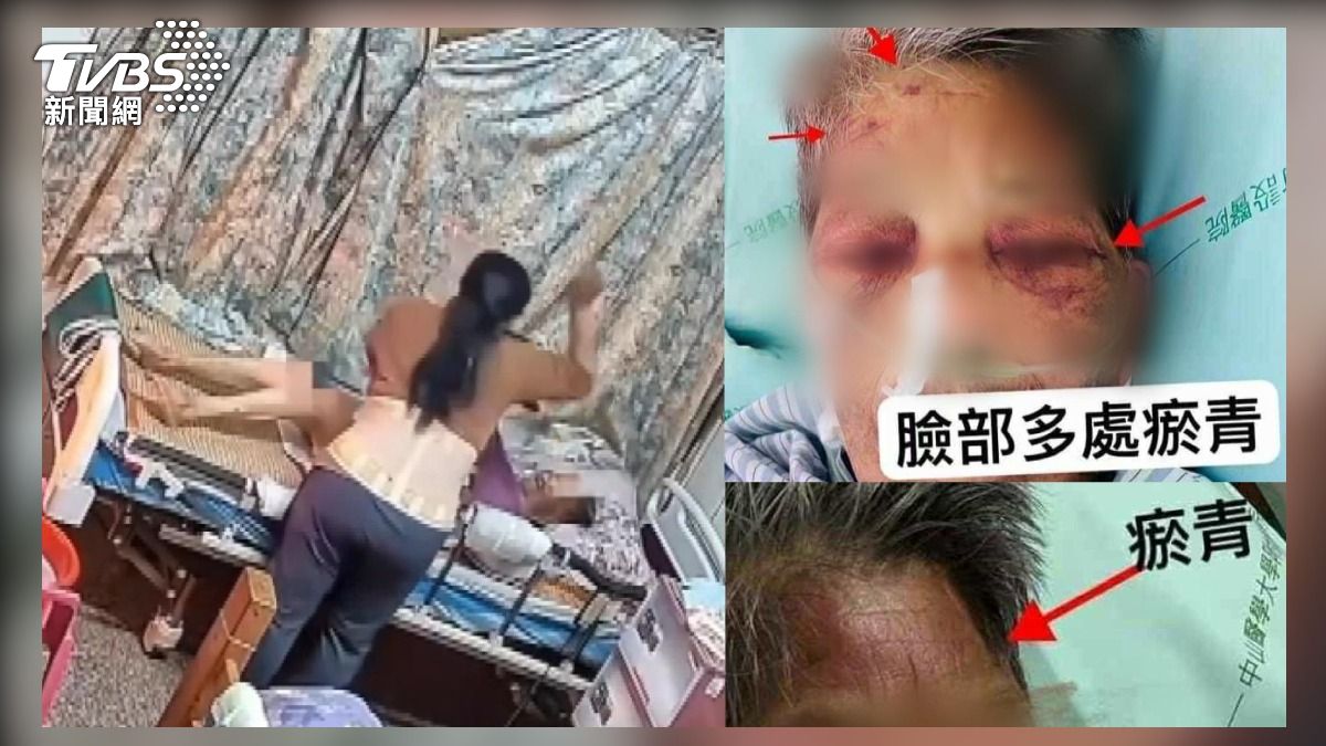 外籍看護狠心毆打臥病阿嬤!家屬調監視器驚見「3個月黑暗真相」