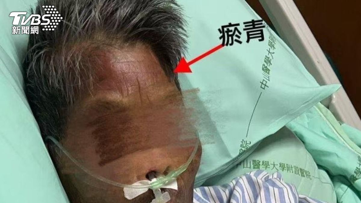 阿嬤頭部傷勢照 圖家屬提供。