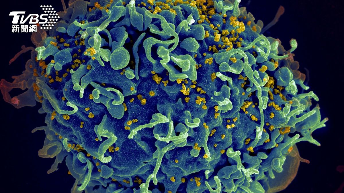 愛滋病有救了?科學家利用mRNA誘使「潛藏HIV病毒」現形