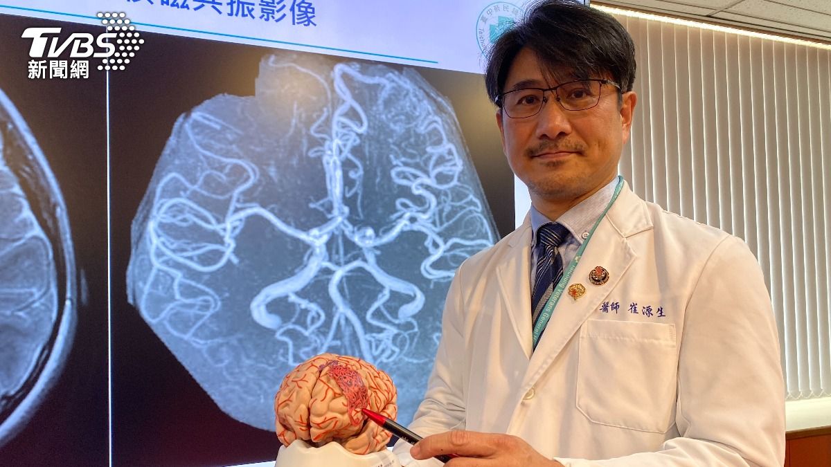 臺中榮總神經醫學中心介入性腦血管外科主任崔源生說明。（圖／TVBS）