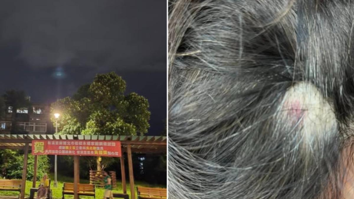 無差別攻擊!北市中正區公園2民眾疑遭石頭丟擲 她當場尖叫
