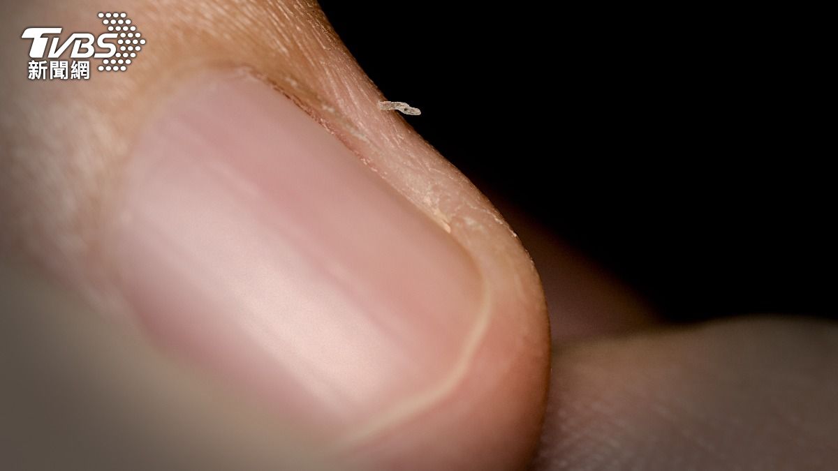 指甲邊緣「小肉刺」超想拔!專家揭背後原因 正確處理方式曝