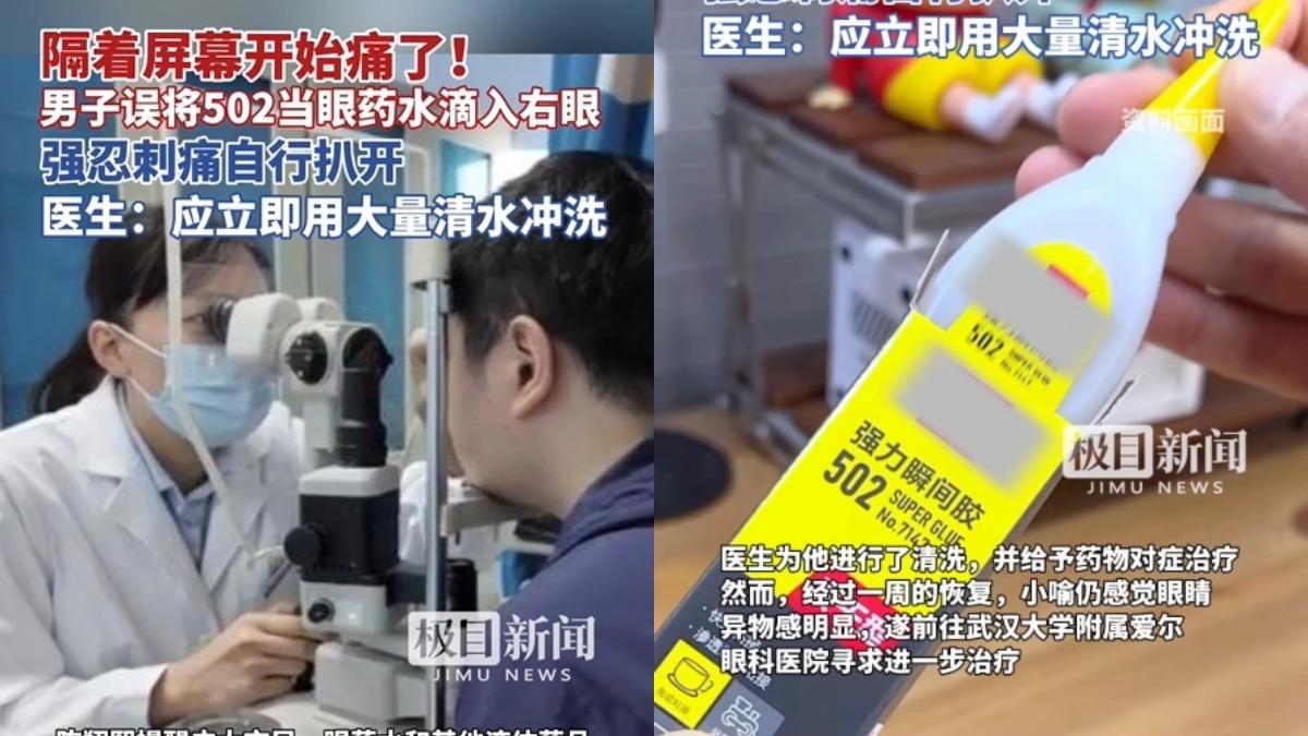 誤將膠水當眼藥水!陸男「右眼角膜灼傷」 醫授1緊急處理方式