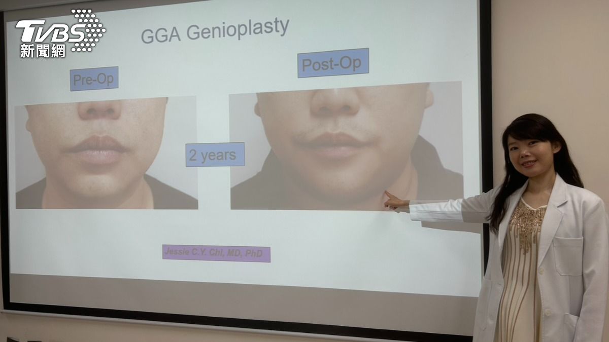 季照芸診斷,陳男下巴內縮,造成呼吸道較正常人狹窄,是釀病主因。(圖/林冠丞攝)