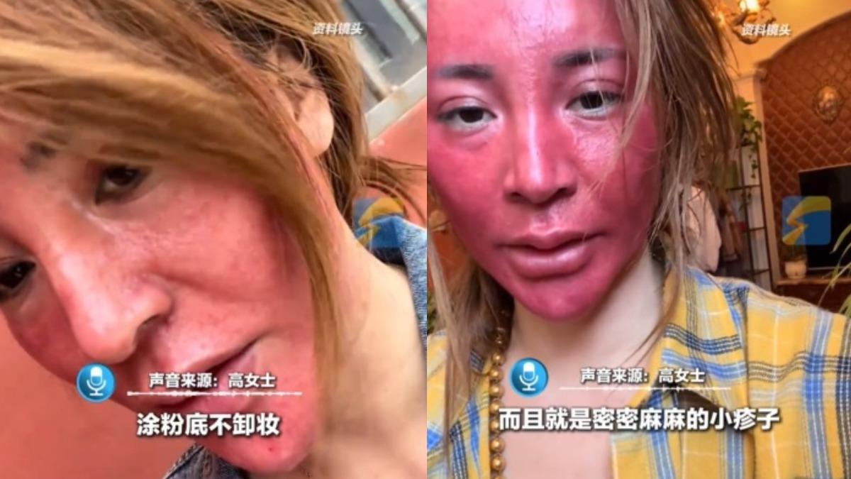 22年不卸妝!陸女臉發燙變硬殼 曬自拍「撞臉關公」