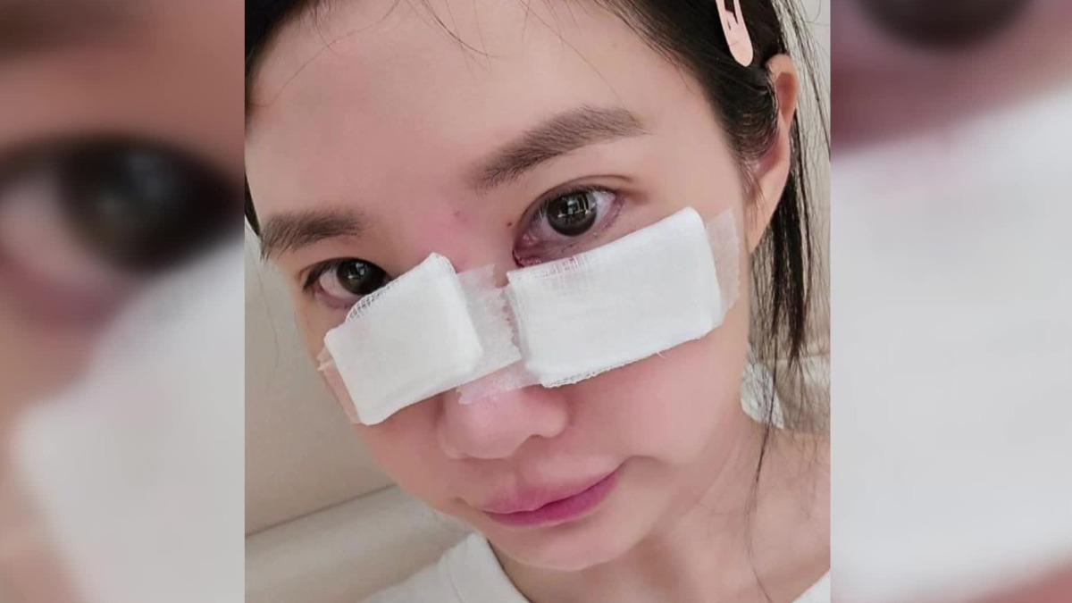 筠熹已經緊急就醫。(圖/翻攝筠熹IG)