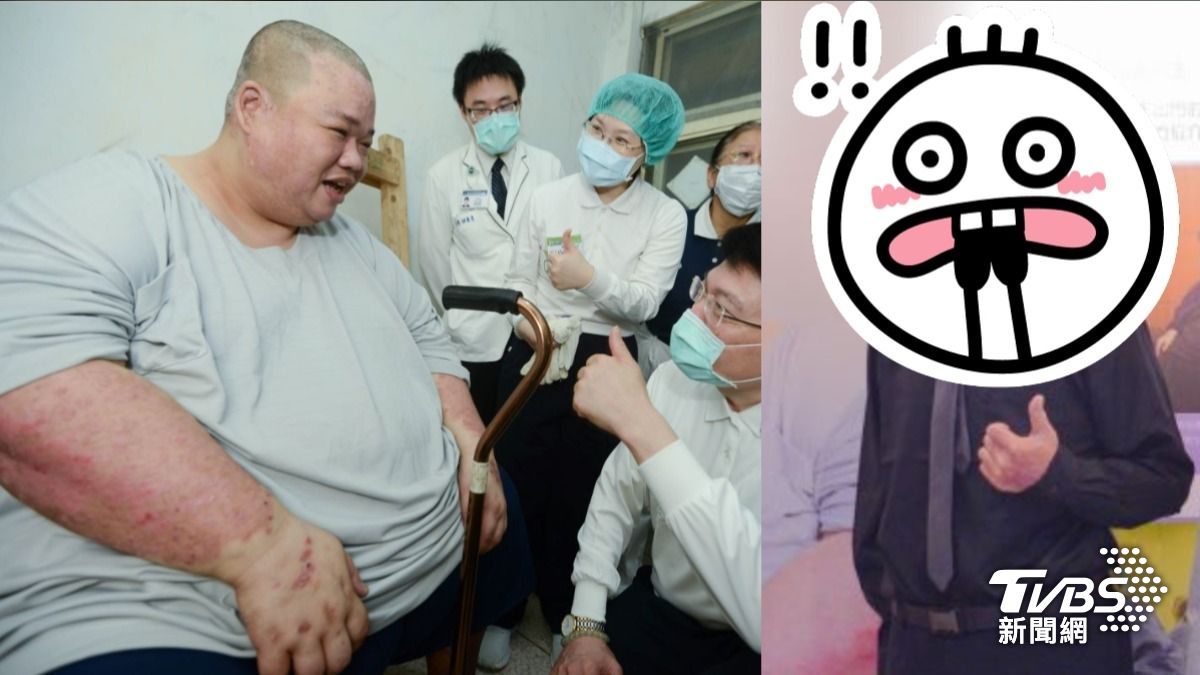 男飆280公斤自卑6年剷200公斤肥肉!45歲浴火重生照片曝