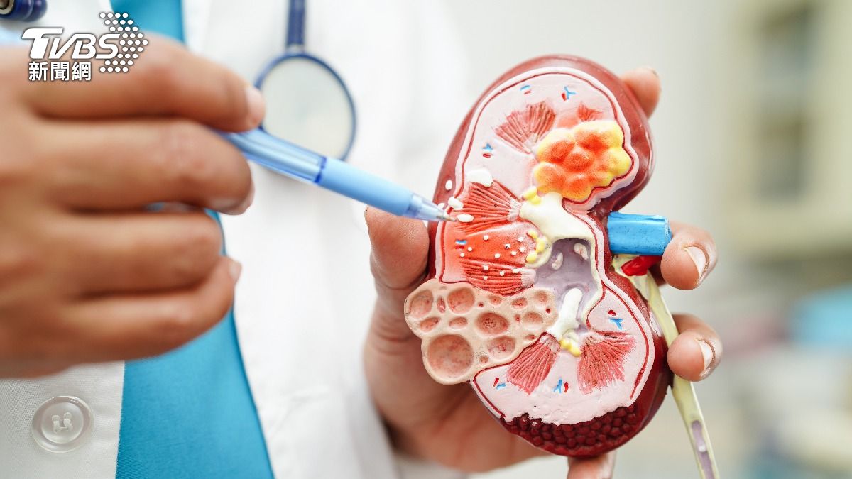 腎臟提前老化「3因素」一次看!醫揭這習慣恐默默吃進腎毒