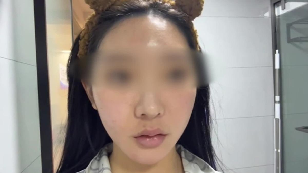 胡小姐指控，在台中某醫美診所施打肉毒、音波以及電波後，出現講話喘、暈，還有無力症狀。（圖／當事人提供）