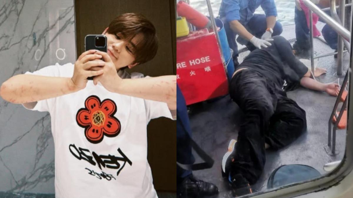 港星姜濤「墜海傷勢照」首曝光!雙臂全疤痕 安撫粉絲:我沒事