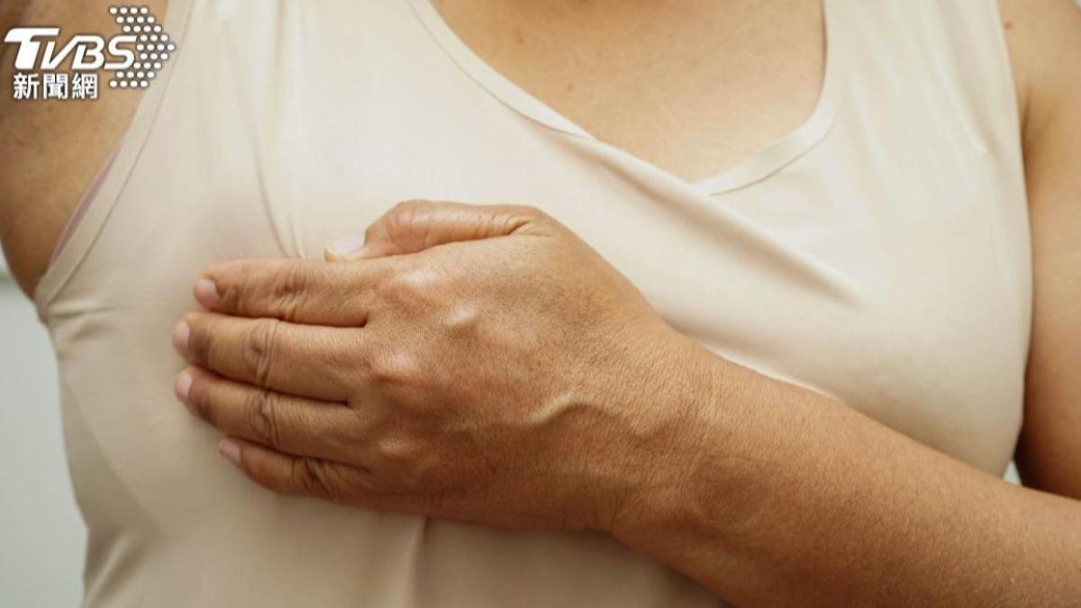 全台7成患者中!「這類乳癌」恐折磨20年 醫:1藥助改善