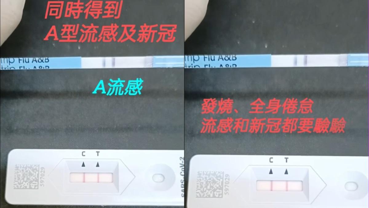 流感跟新冠會同時中?醫曝解答 8歲天選男童慘遇三病夾擊