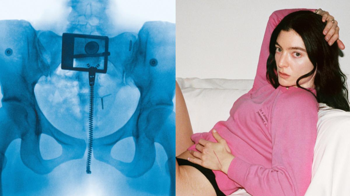好大膽！女星挑戰極致裸露　公開「骨盆X光片」驚見避孕器