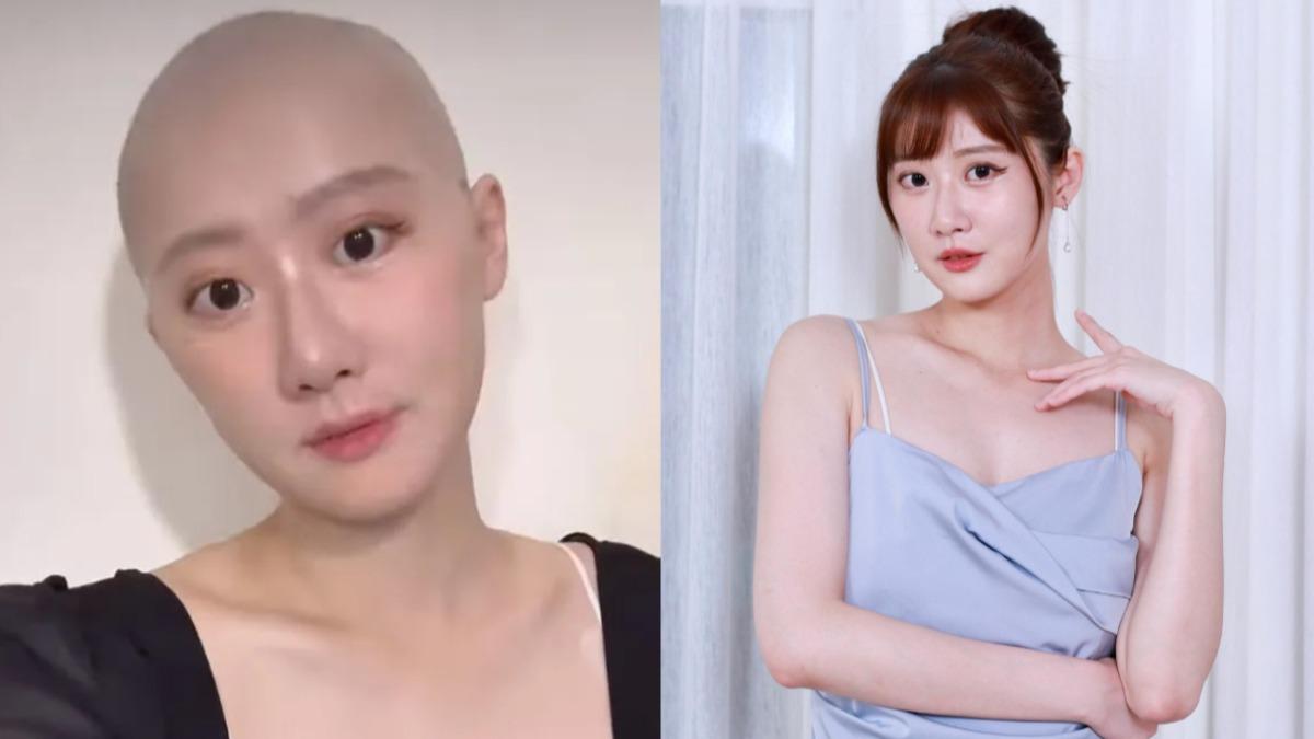 32歲女星罹「惡性癌症」!苦熬化療6次掉髮 半夜痛哭:想活著