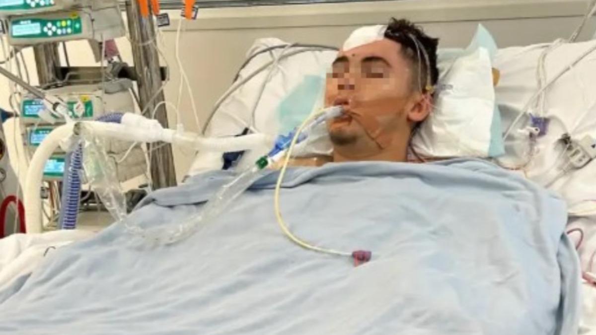 澳少年與女友同居太興奮!慶祝時「後空翻失敗」 頭撞地身亡