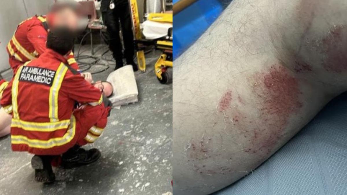 醫護人員緊急救治法拉爾的「小兄弟」,另外腿部也受到嚴重擠壓傷,幸好不用截肢。(圖/翻攝自 Daily Mail)