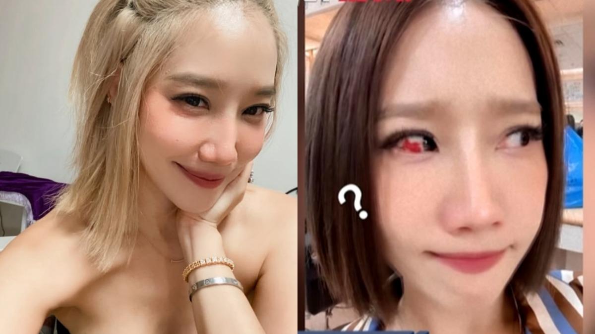 楊皓如左半身出問題! 「爆出血輪眼」查不到原因:現代人就是賤命