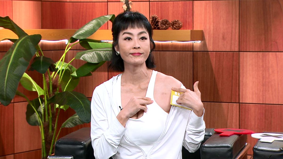 唐玲左肩的人工血管已取出，樂觀表示疤痕是戰勝病魔的光榮印記。（圖／年代提供）