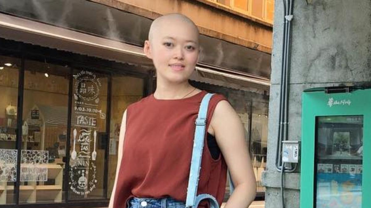 本土女星「罹淋巴癌」!新婚才2個月 頭髮全掉光崩潰