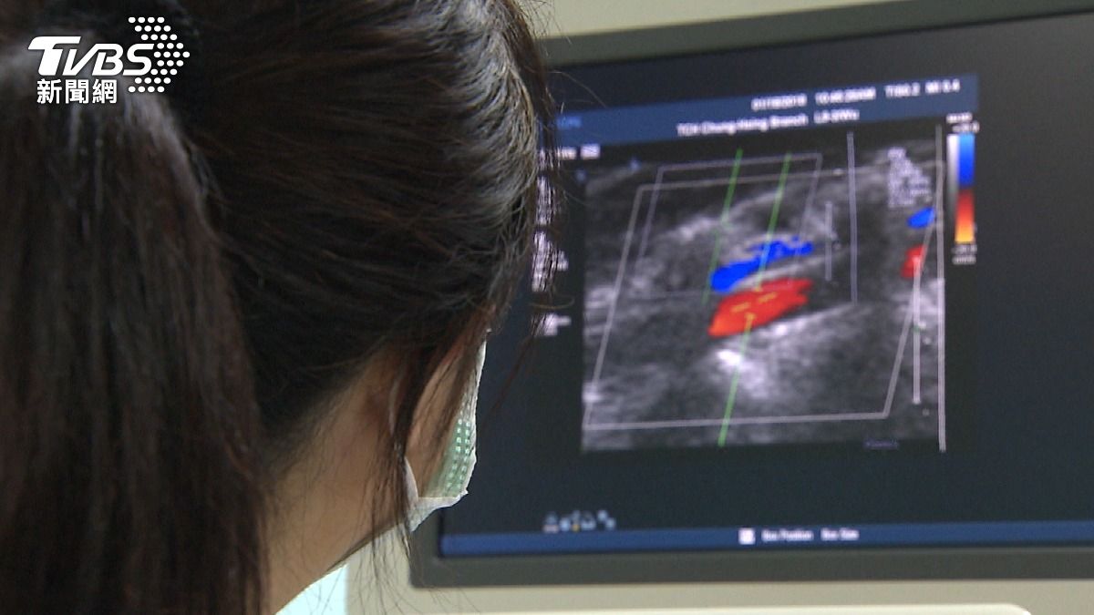 甲亢易被誤認更年期!醫曝高危險族群 。 (圖/TVBS)