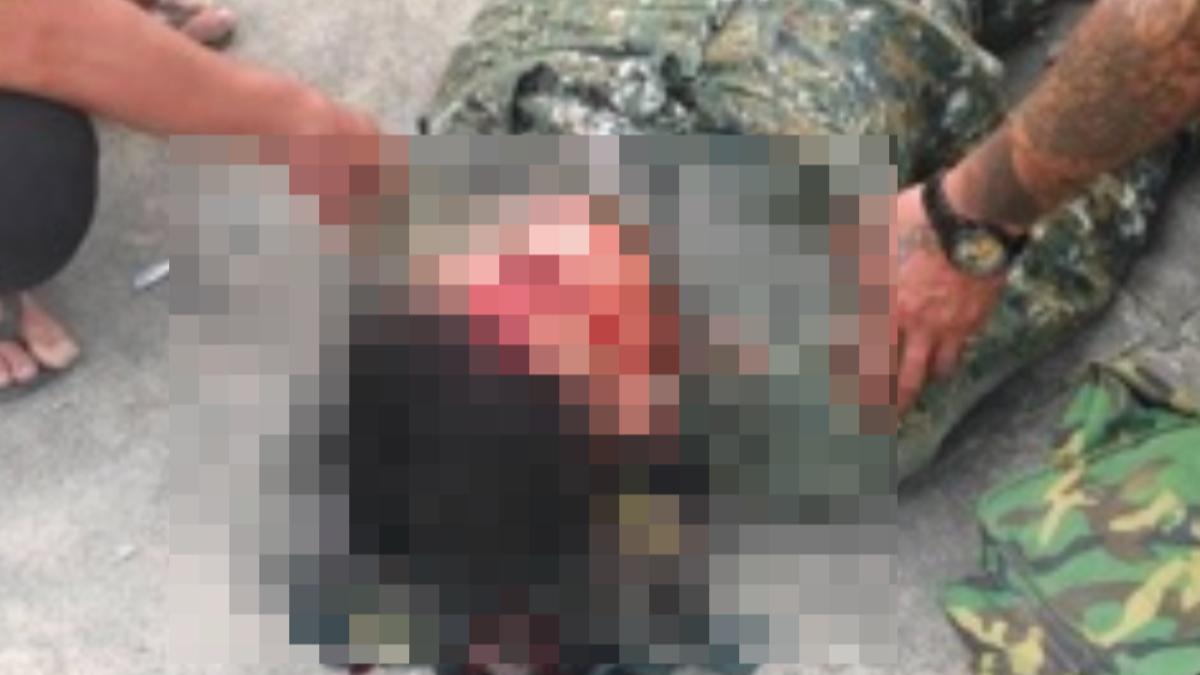 軍車詭異自撞!3士兵急送醫「血流滿面」 安全氣囊一片紅
