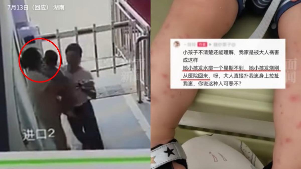 1歲男童遭鄰居強吻!紅疹爬滿全身 陸媽氣炸:剛從醫院回來