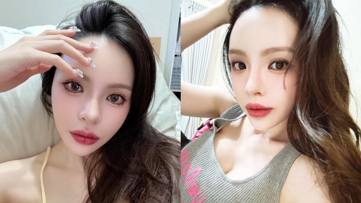 詩亞大方談「整形臉」醫美經驗!幽默自信轉念回應:我保養得太好了