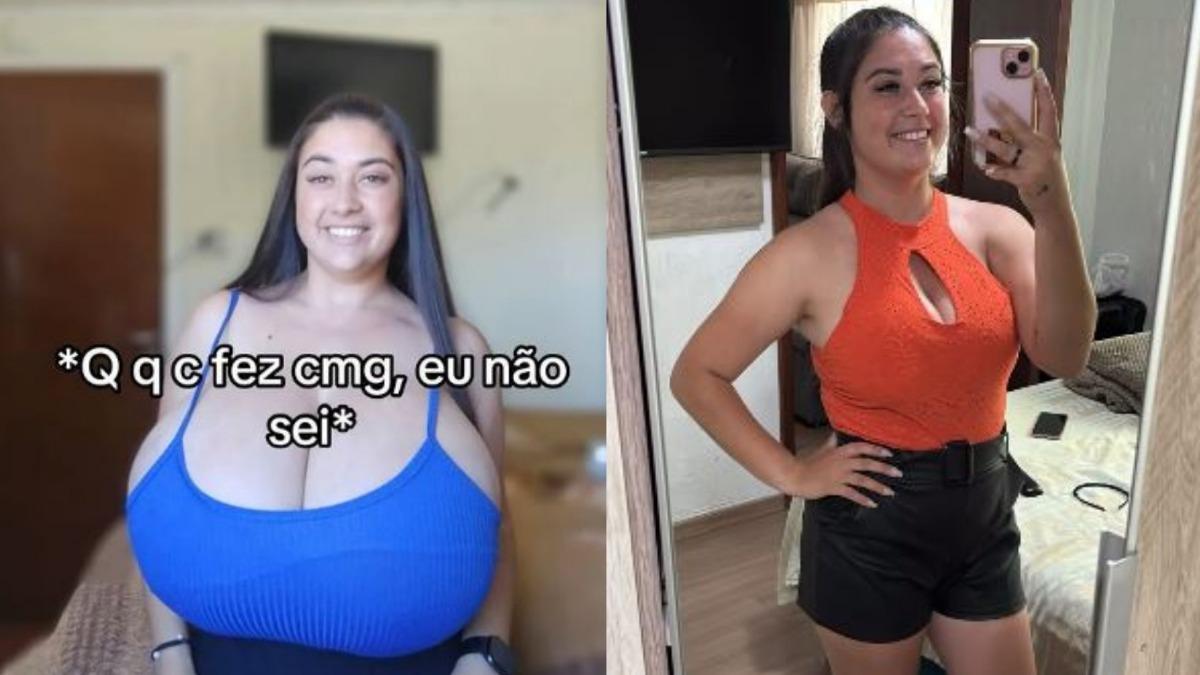 經過手術,女子的胸部終於恢復正常大小。(圖/取自IG)