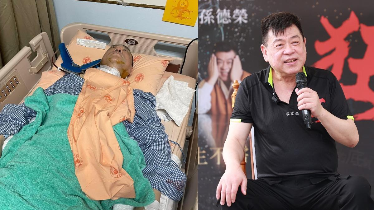 孫德榮「脊椎開刀」9小時手術成功! 插管病榻模樣曝光