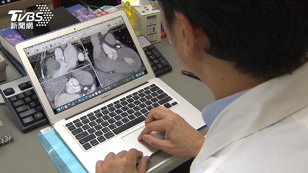 心跳偏快恐疾病徵兆 醫:靜止心率要注意!(圖/TVBS)
