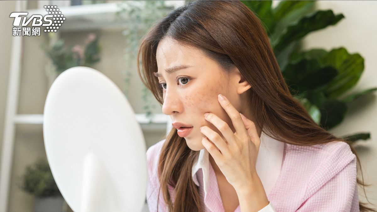 狂冒痘痘超困擾!「5大習慣」超容易踩雷 快檢查中了幾項