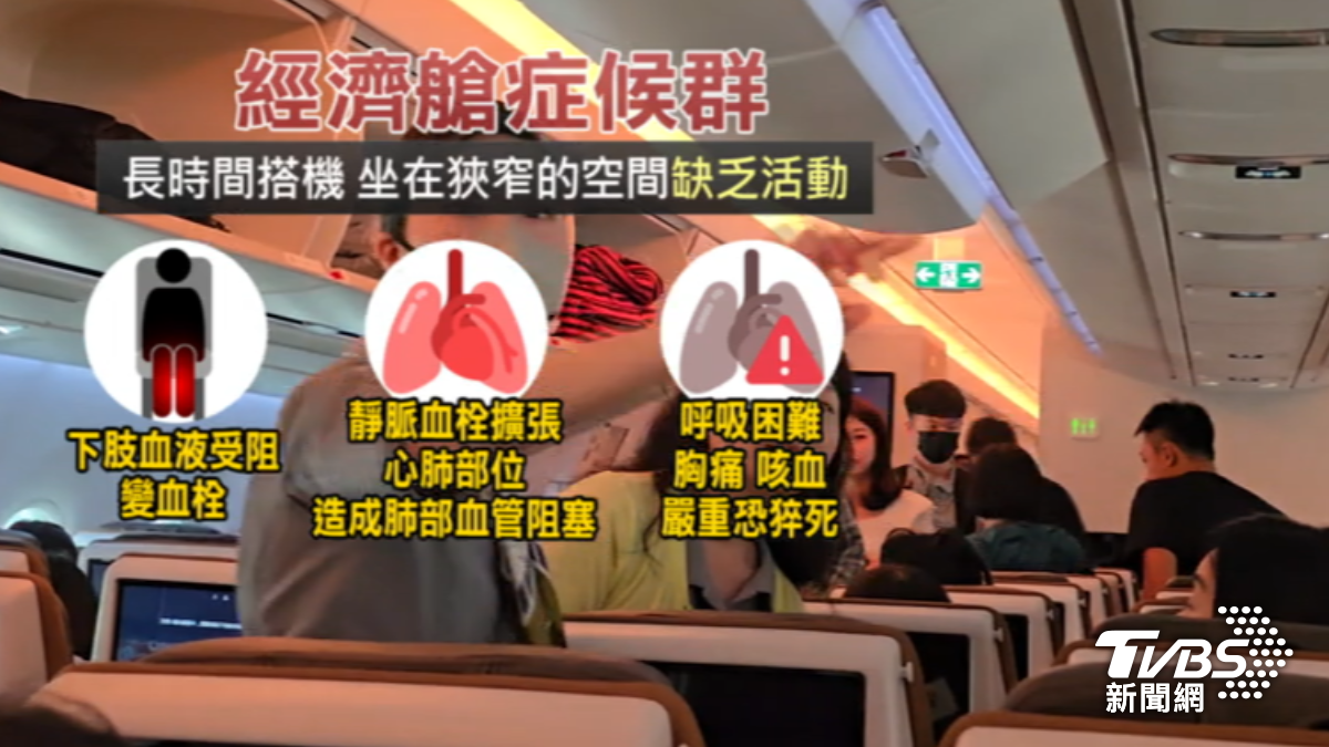 搭機久坐超過4小時容易造成血栓。（圖／TVBS）
